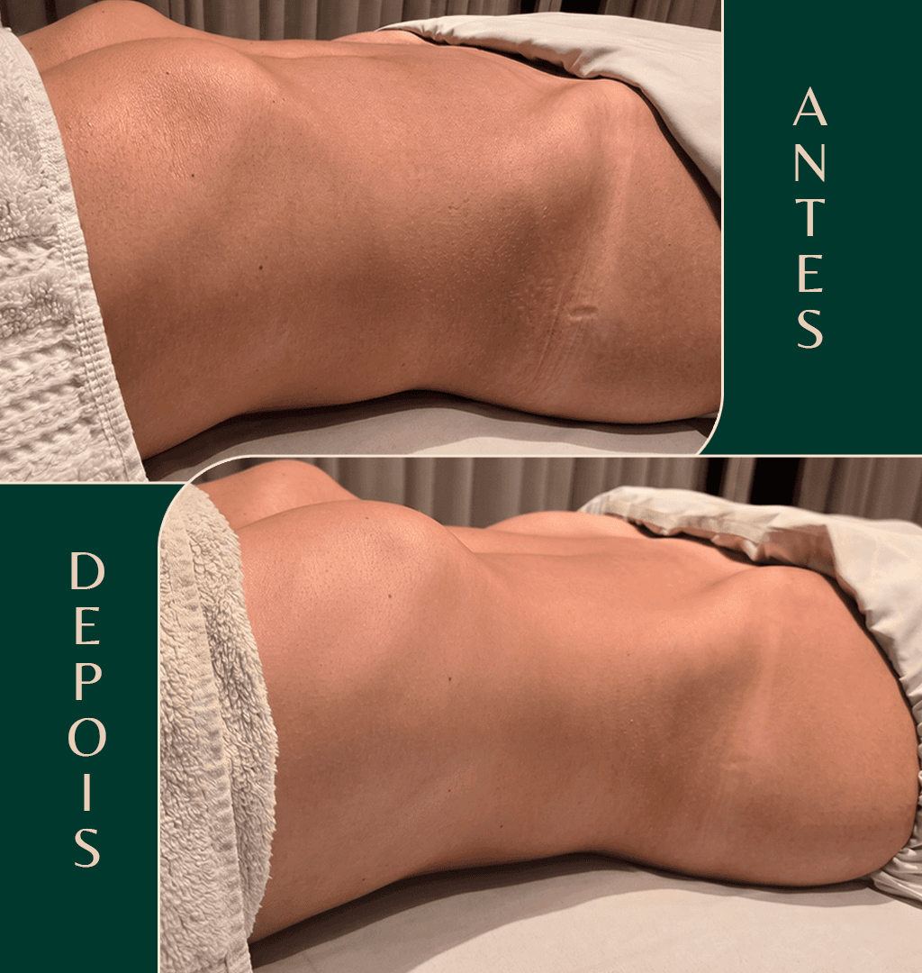 Resultado antes e depois